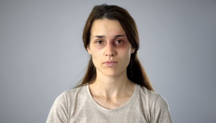 Apply for ILR as a Victim of Domestic Abuse: Part 2